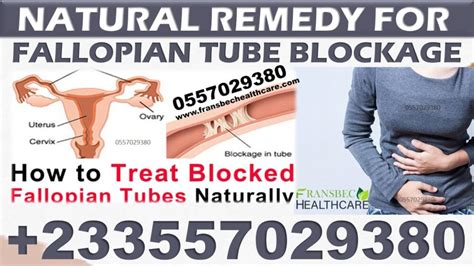 Best Solution For Blocked Fallopian Tubes In Ghana We Deliver