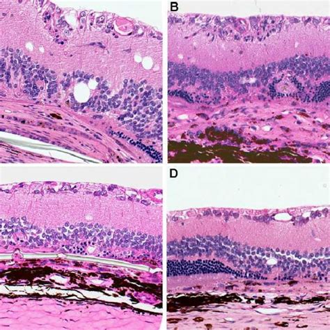 Hematoxylin And Eosin Stained Sections Of Hesc Rpe Implanted Or