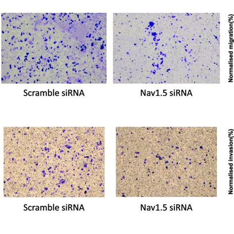 Nav15 Knockdown Inhibited Migration And Invasion Of Hsc 3 Cells Hsc 3