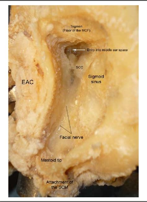 Figure 1 From Clinical Strategies For The Management Of Acute