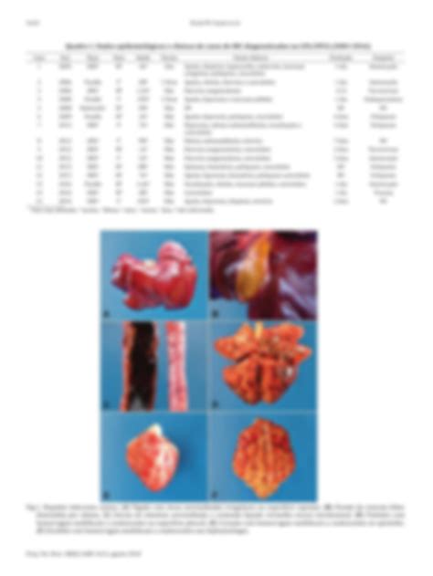 Solution Aspectos Epidemiol Gicos Cl Nicos E Anatomopatol Gicos Da