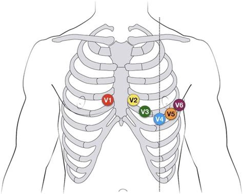 Medsurg Final Flashcards Quizlet