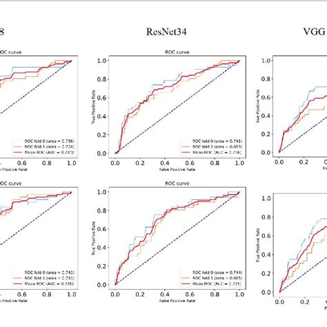 | ROC curves of the comparison models. (A) ROC plots for different ...