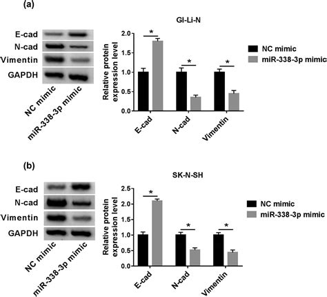 MiR 338 3p Inhibits Cell Growth Invasion And EMT Process In