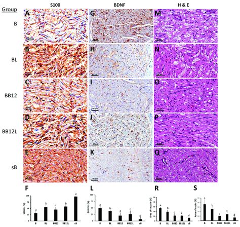 S100 (A-E), BDNF (G-K) immunohistochemical staining, and H&E (M-Q ...