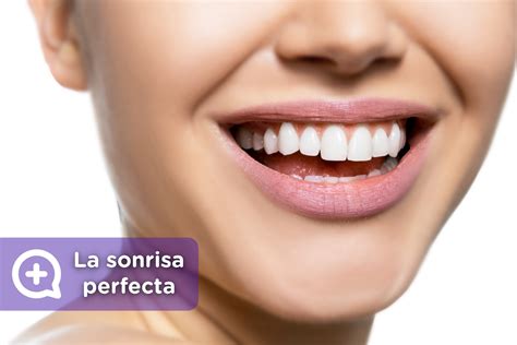 Dientes blancos cómo conseguir una sonrisa perfecta mediQuo