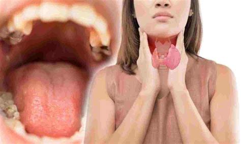 Lips Cancer Symptoms In Hindi Lipstutorial Org