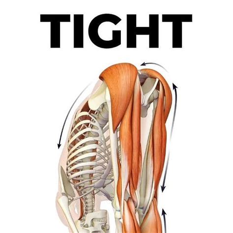 Understanding Tight Hamstrings: Causes and Solutions