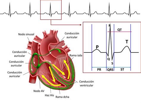 Complejo QRS