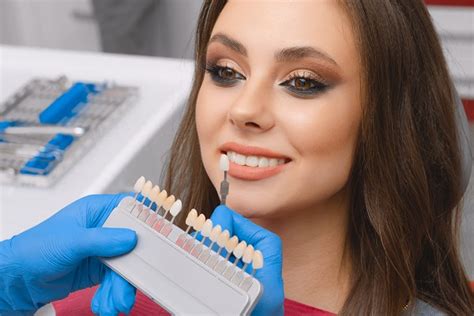 What To Know About The Dental Veneers Procedure Oakland Dental