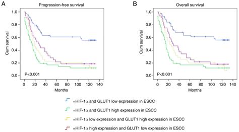 Prognostic Impact Of The Combination Of Hif‑1α And Glut1 In Patients