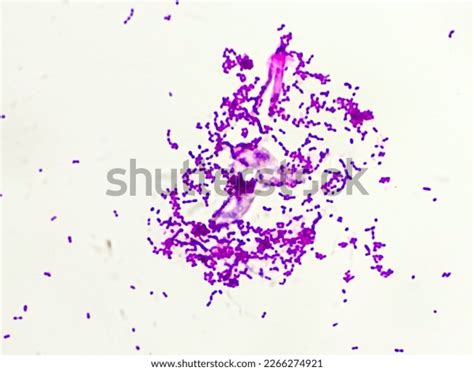 Gram Positive Cocci Bacteria Gram Staining Stock Photo 2266274921 ...