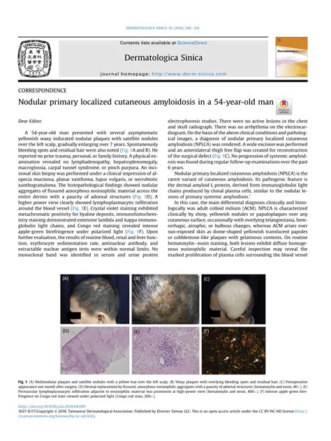 Pdf Nodular Primary Localized Cutaneous Amyloidosis In A 54 Year Old Man