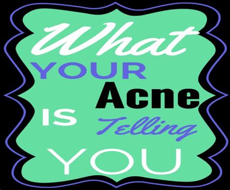 What Your Acne Is Telling You The Beauty Section Acne Treatment