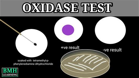 Oxidase Test