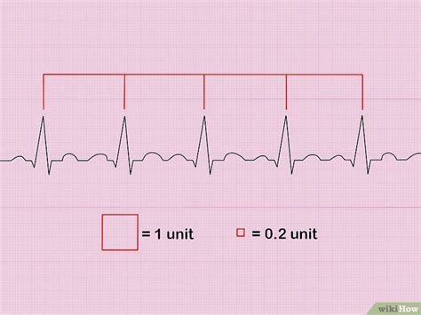 Cómo Calcular La Frecuencia Cardiaca A Partir De Un Ecg