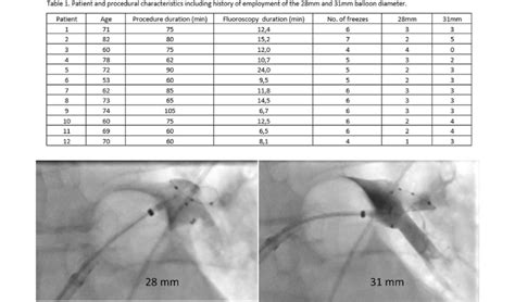 Representative Example Of Cryoballoon Configuration And Pulmonary Vein Download Scientific