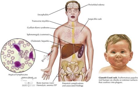 Viral Infections Clinical Gate