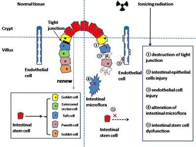 Frontiers Research Progress On The Mechanism Of Radiation Enteritis