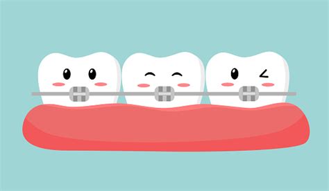 Ilustración De Dientes Con Dibujos Animados De Soporte De Ortodoncia En