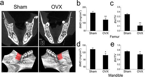 Micro Ct And Quantification Of Mouse Mandible And Femur A Micro Ct