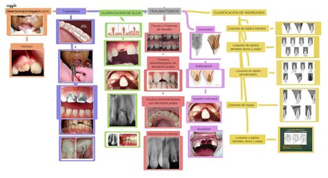 Traumatismos Dentales Clasificaci N Forensic Notes Udocz