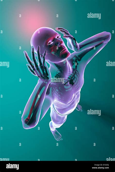 Headache - Anatomy Stock Photo - Alamy