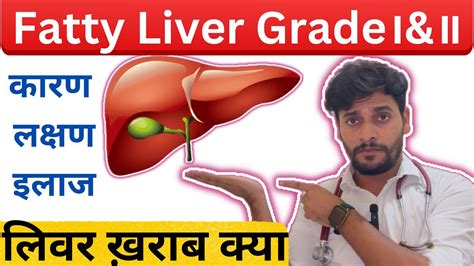 Don T Ignore Fatty Liver Grade 1 2 YouTube