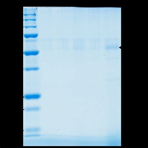 Sds Page With Coomassie Blue Staining Of Proteins From Mrjp1 Producing Download Scientific