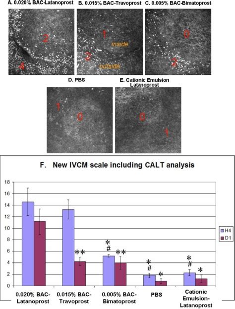 Ivcm Images Of Rabbit Calt After Instillations With Different Pg Eye