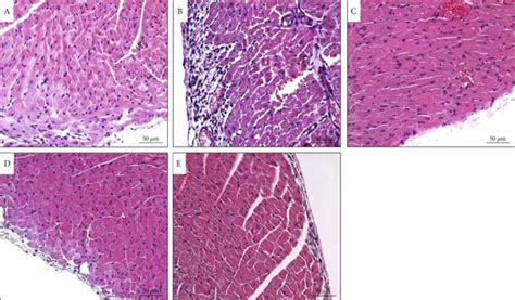 The Qx Formula Ameliorated The Disruption Of Cardiac Structure In