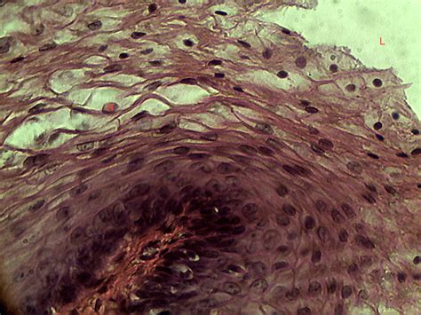 Histology Of Epithelial Tissue