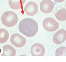 Erythropoiesis And Erythocytosis Flashcards Quizlet