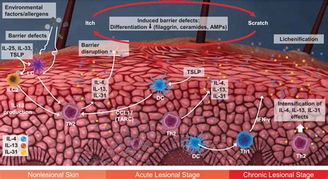 Approach To The Assessment And Management Of Adult Patients With Atopic