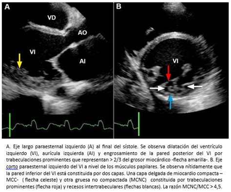 Ecocardiografía Y Doppler Cardíaco