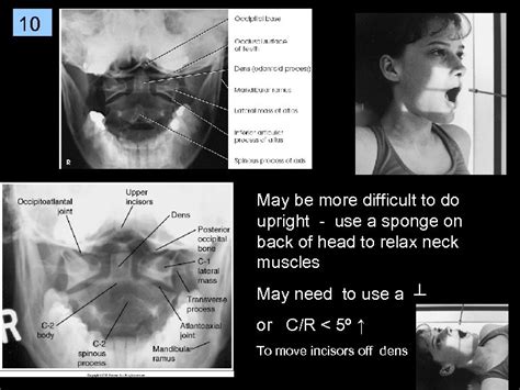 1 Cervical Spine Rtec 124 Week 6 Rev