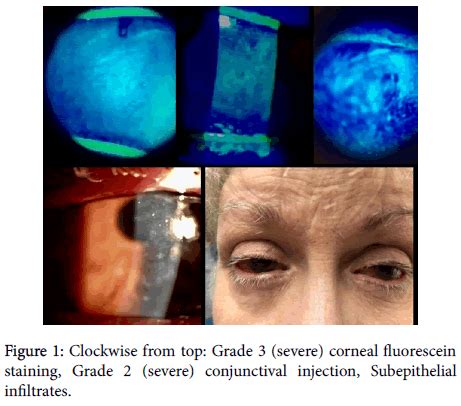 Clinical Experimental Ophthalmology Clockwise