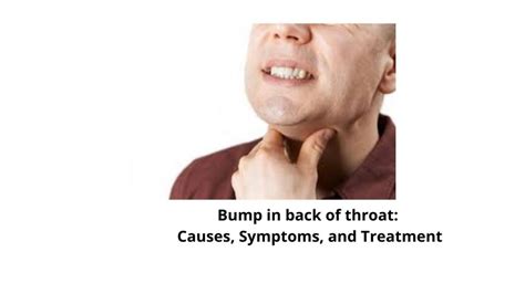 Bump in back of throat: Causes, Symptoms, and Treatment ...