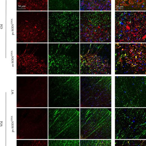 S100B Increase In GFAP Positive Cells In The Lumbar Spinal Cord From