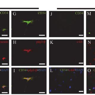 Double Immunofluorescent Staining For CD34 C Kit CD34 Vimentin And