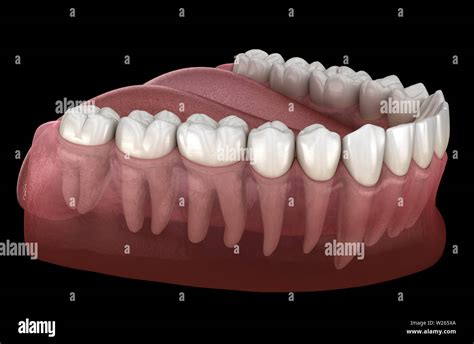 Morphology Of Mandibular Human Gum And Teeth Medically Accurate Tooth