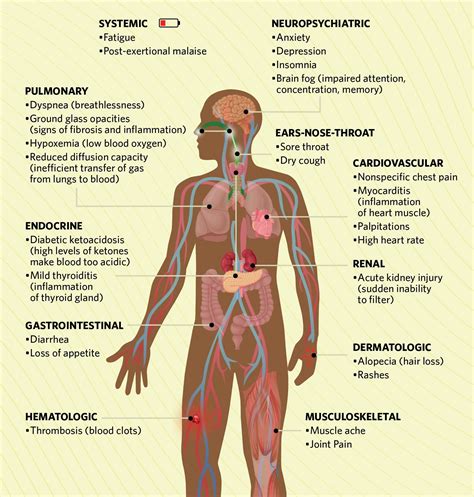 Infographic Bodily Systems Affected By Long Covid The Scientist