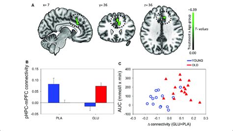 A Resting State Functional Connectivity Rsfc Brain Map For Left