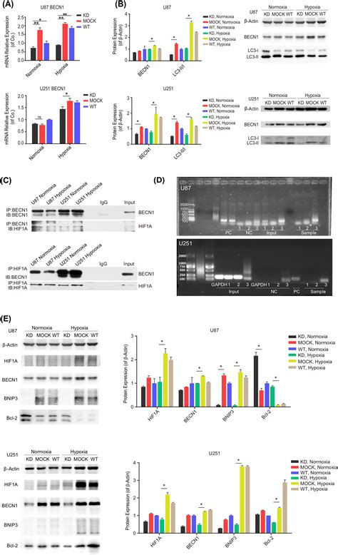 Hypoxia Induced Autophagy Is Involved In Radioresistance Via Hif1a