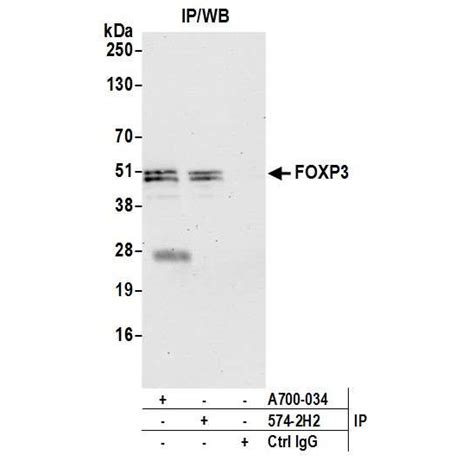 Foxp3 Critical For The Immunosuppressive Function Of Regulatory T Cells