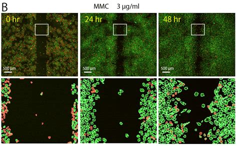 Time Lapse Analysis Of Cell Migration And Proliferation In Scratch Assay Yokogawa Turkey