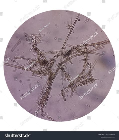 Malassezia Furfur Microscopic Morphology