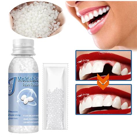 Temporary Resin Tooth Repair Glue Shapeable Falseteeth Gaps Filling Solid Glue Fake Teeth Repair