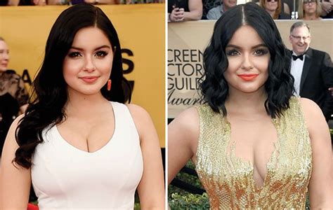 5 Celebrity Breast Reductions: Inspiring Stories of Confidence | Breast