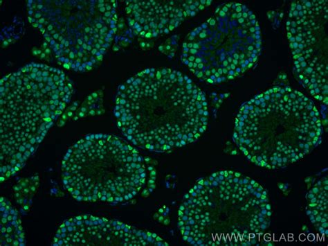 PARP1 Antibody 80174 1 RR Proteintech